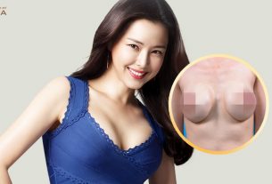 Phẫu thuật ngực hỏng - Công nghệ tiên tiến bệnh viện thẩm mỹ MEDIKA - nangngucxe.vn