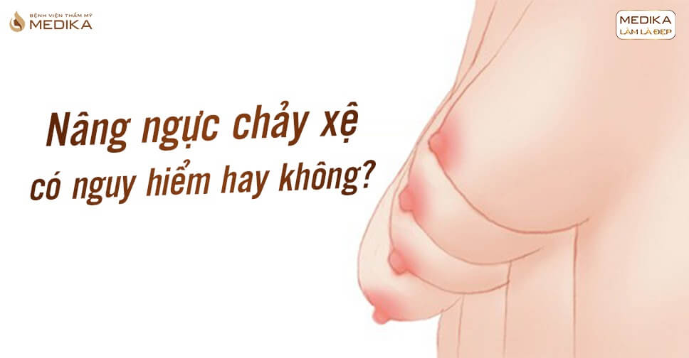 Nâng ngực chảy xệ có nguy hiểm không tại Nangngucxe.vn?