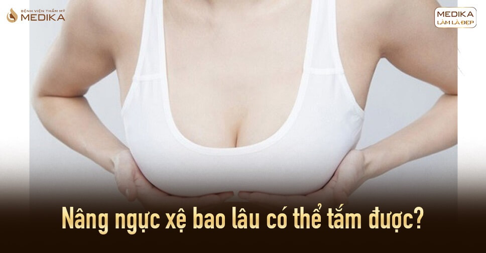 Nâng ngực xệ bao lâu có thể tắm được từ Nangngucxe.vn?