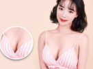 MEDIKA chuyên gia phẫu thuật nâng ngực cho Hot Girl - Tại Nangngucxe.vn